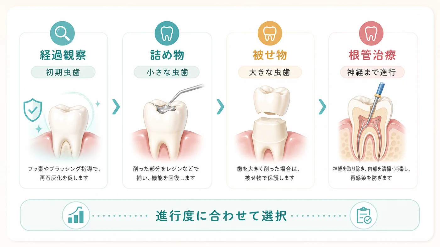 虫歯の治療方法
